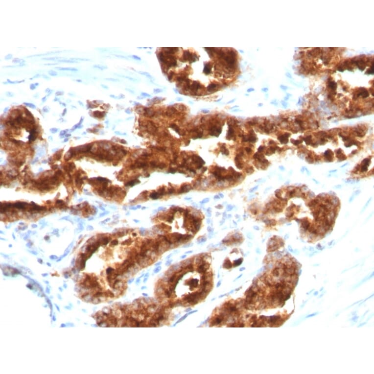 Immunohistochemistry - Anti-TAG72 Antibody [B72.3] (A248356) - Antibodies.com