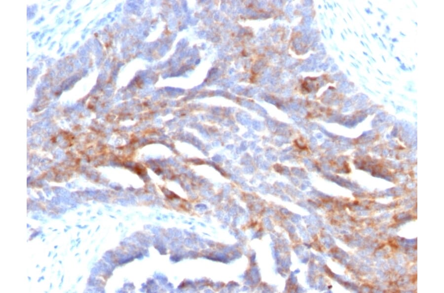 Immunohistochemistry - Anti-TAG72 Antibody [B72.3] (A248356) - Antibodies.com