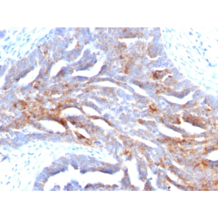 Immunohistochemistry - Anti-TAG72 Antibody [B72.3] (A248356) - Antibodies.com