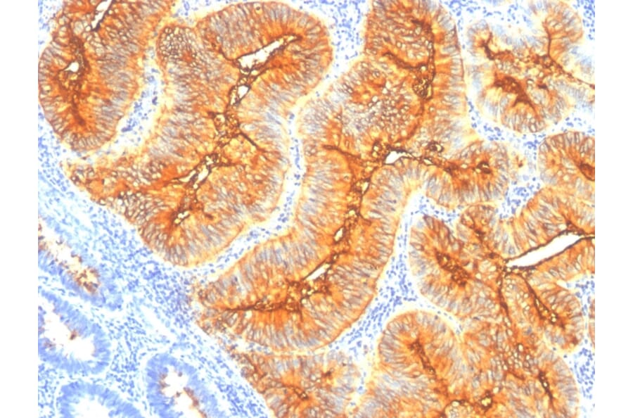 Immunohistochemistry - Anti-TAG72 Antibody [B72.3] (A248355) - Antibodies.com