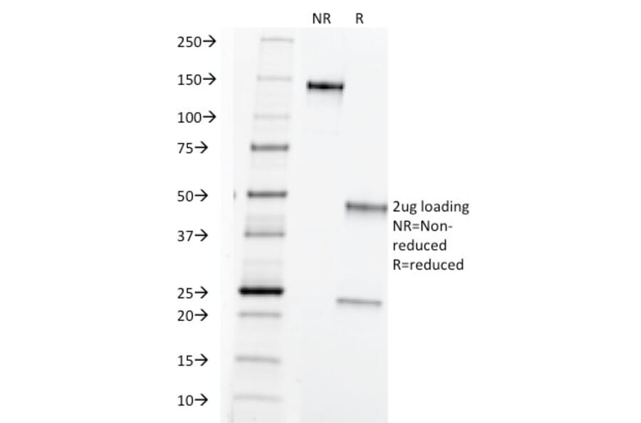 SDS-PAGE - Anti-TAG72 Antibody [B72.3] (A248356) - Antibodies.com