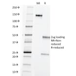 SDS-PAGE - Anti-TAG72 Antibody [B72.3] (A248356) - Antibodies.com