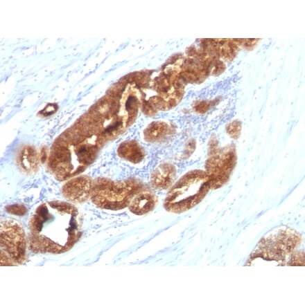 Immunohistochemistry - Anti-TAG72 Antibody [CC49] (A248358) - Antibodies.com