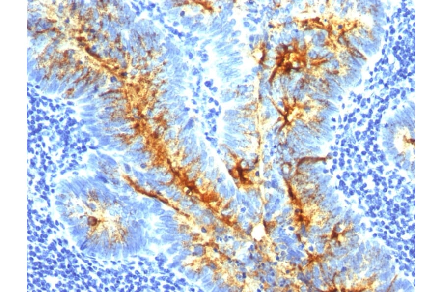Immunohistochemistry - Anti-TAG72 Antibody [SPM536] (A248358) - Antibodies.com