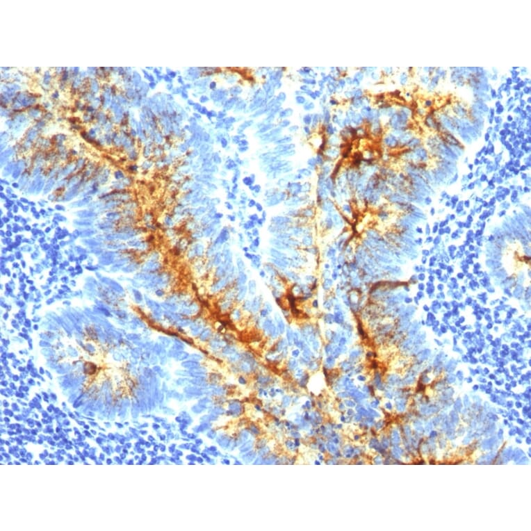 Immunohistochemistry - Anti-TAG72 Antibody [SPM536] (A248358) - Antibodies.com