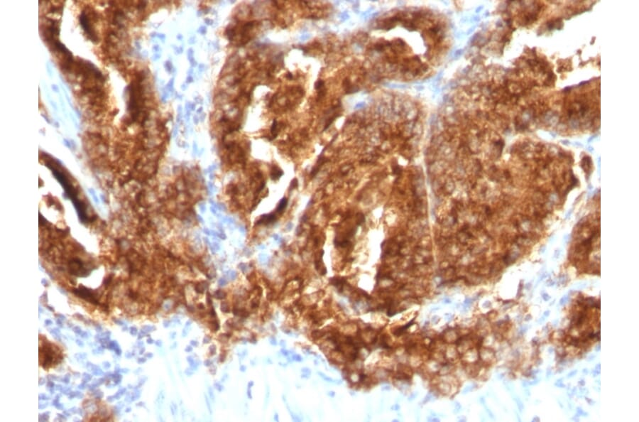 Immunohistochemistry - Anti-TAG72 Antibody [CA72/733] (A248360) - Antibodies.com