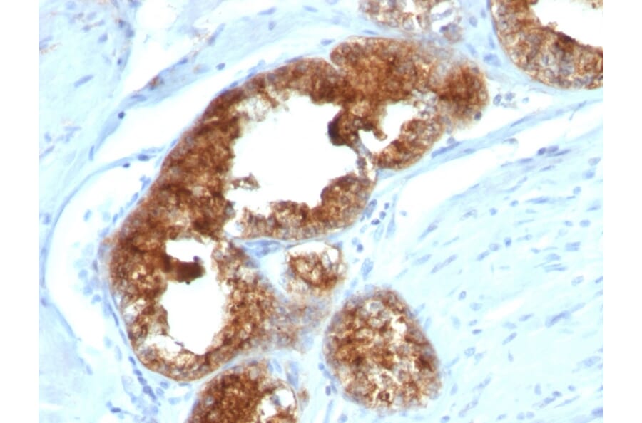 Immunohistochemistry - Anti-TAG72 Antibody [B72.3 + CA72/733] (A248361) - Antibodies.com
