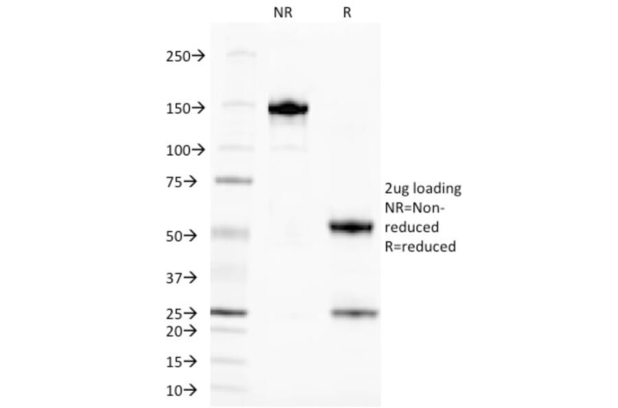 SDS-PAGE - Anti-TAG72 Antibody [CA72/145] (A248362) - Antibodies.com