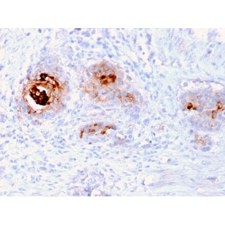 Immunohistochemistry - Anti-TAG72 Antibody [rB72.3] (A248363) - Antibodies.com