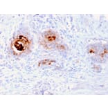 Immunohistochemistry - Anti-TAG72 Antibody [rB72.3] (A248363) - Antibodies.com