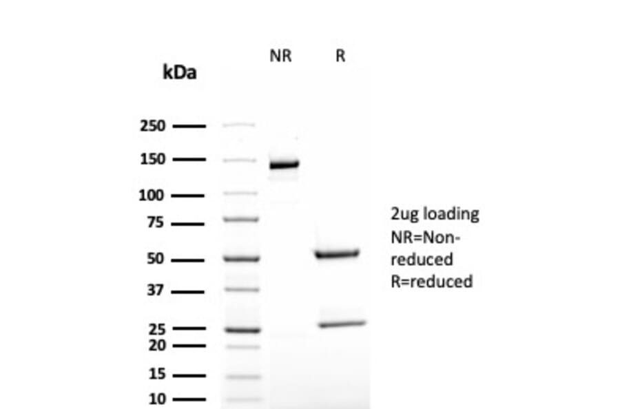 SDS-PAGE - Anti-TAG72 Antibody [rB72.3] (A248364) - Antibodies.com