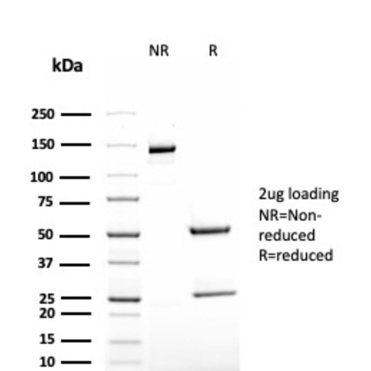 SDS-PAGE - Anti-TAG72 Antibody [rB72.3] (A248364) - Antibodies.com