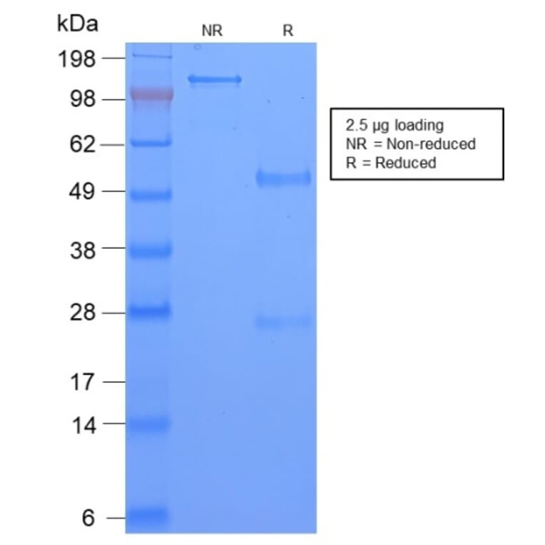 SDS-PAGE - Anti-TAG72 Antibody [CA72/2869R] (A248365) - Antibodies.com