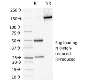 SDS-PAGE - Anti-Desmoglein 1 Antibody [18D4] (A248365) - Antibodies.com