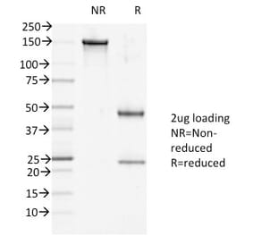 SDS-PAGE - Anti-Desmoglein 1 Antibody [27B2] (A248366) - Antibodies.com