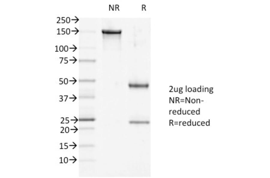 SDS-PAGE - Anti-Desmoglein 1 Antibody [27B2] (A248366) - Antibodies.com