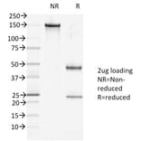 SDS-PAGE - Anti-Desmoglein 1 Antibody [27B2] (A248366) - Antibodies.com