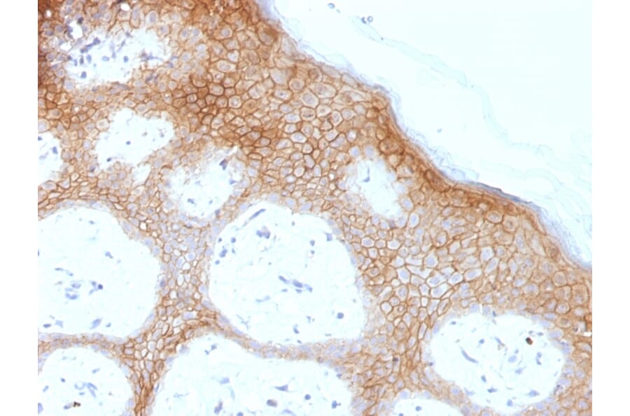 Immunohistochemistry - Anti-Desmoglein 1 Antibody [DSG1/1733] (A248367) - Antibodies.com