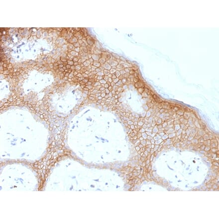 Immunohistochemistry - Anti-Desmoglein 1 Antibody [DSG1/1733] (A248367) - Antibodies.com