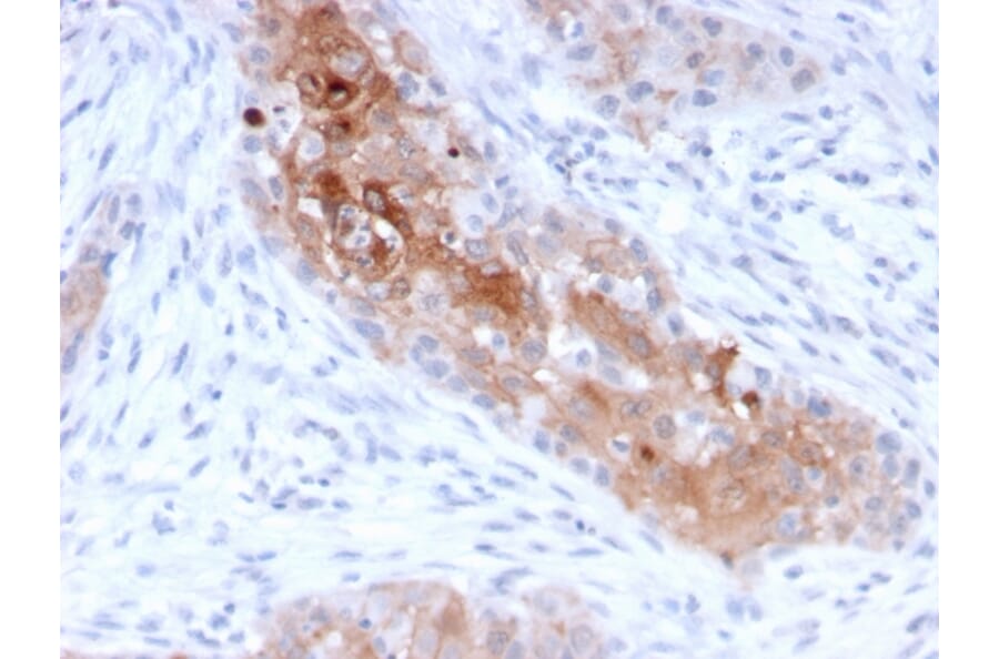 Immunohistochemistry - Anti-Desmoglein 1 Antibody [32-2B] (A248369) - Antibodies.com