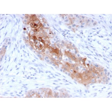 Immunohistochemistry - Anti-Desmoglein 1 Antibody [32-2B] (A248369) - Antibodies.com