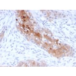 Immunohistochemistry - Anti-Desmoglein 1 Antibody [32-2B] (A248369) - Antibodies.com