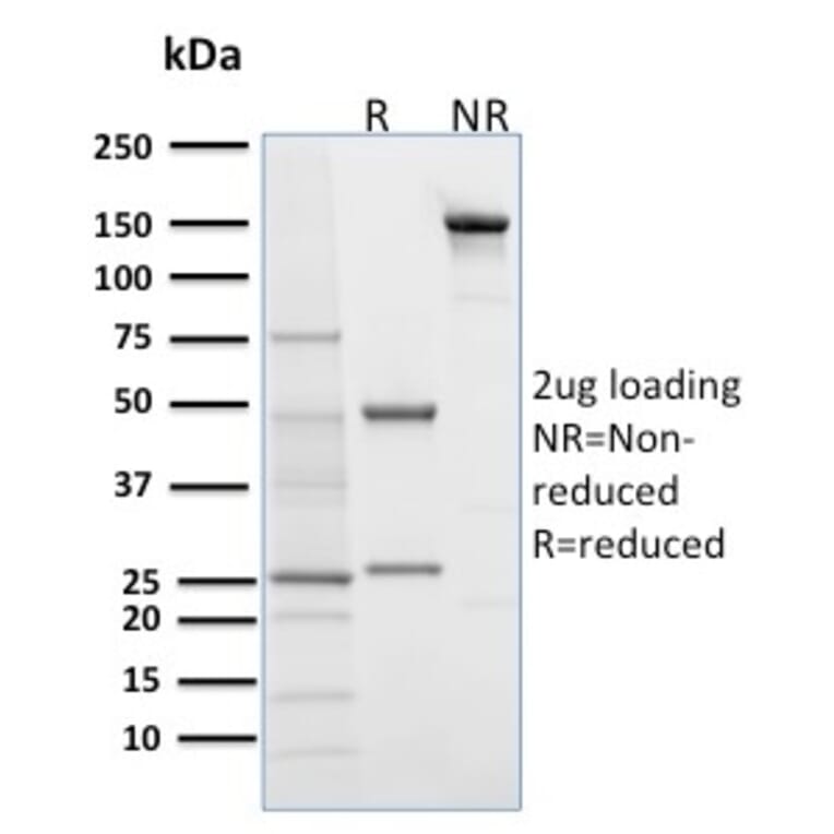 SDS-PAGE - Anti-Desmoglein 1 Antibody [32-2B] (A248369) - Antibodies.com