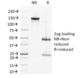 SDS-PAGE - Anti-Desmoglein 2 Antibody [6D8] (A248369) - Antibodies.com