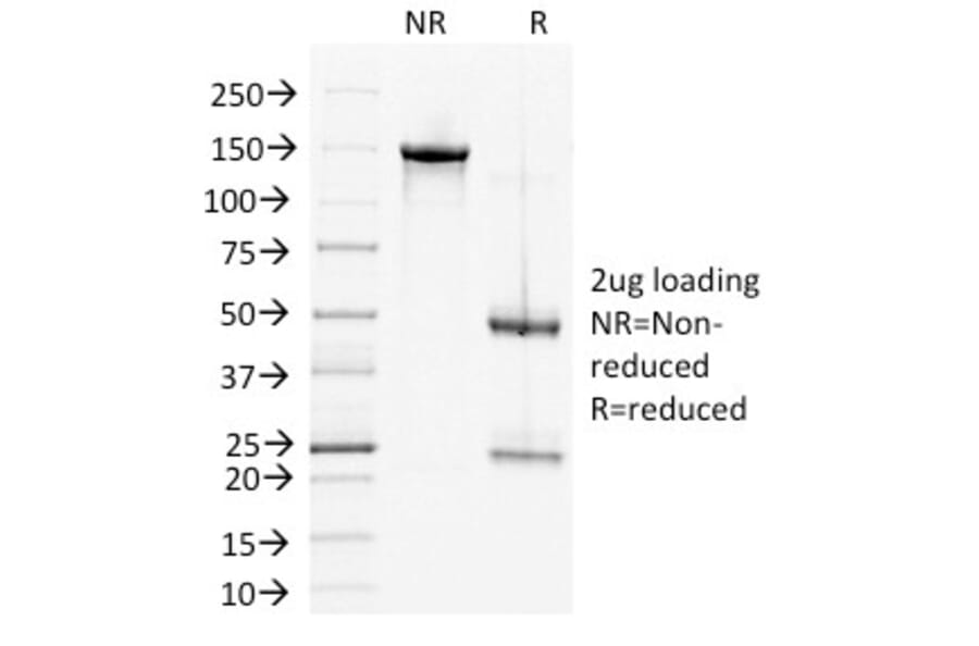 SDS-PAGE - Anti-Desmoglein 2 Antibody [6D8] (A248369) - Antibodies.com