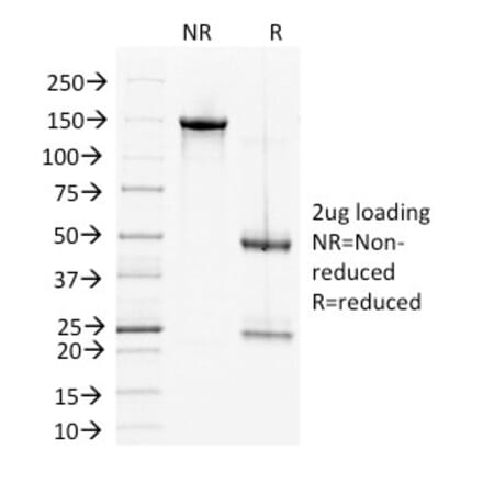 SDS-PAGE - Anti-Desmoglein 2 Antibody [6D8] (A248369) - Antibodies.com