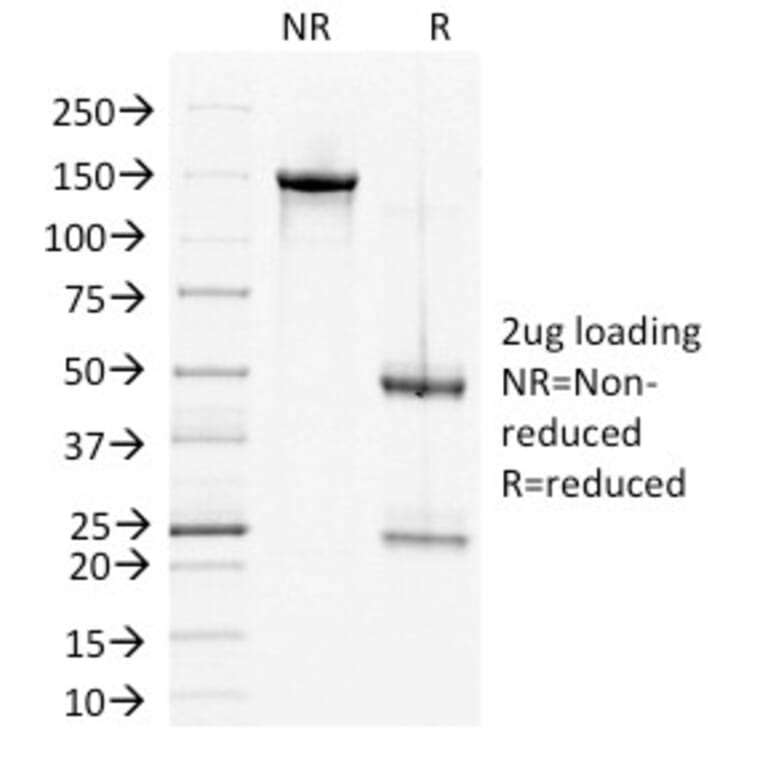 SDS-PAGE - Anti-Desmoglein 2 Antibody [6D8] (A248369) - Antibodies.com