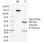 SDS-PAGE - Anti-Desmoglein 2 Antibody [6D8] (A248369) - Antibodies.com