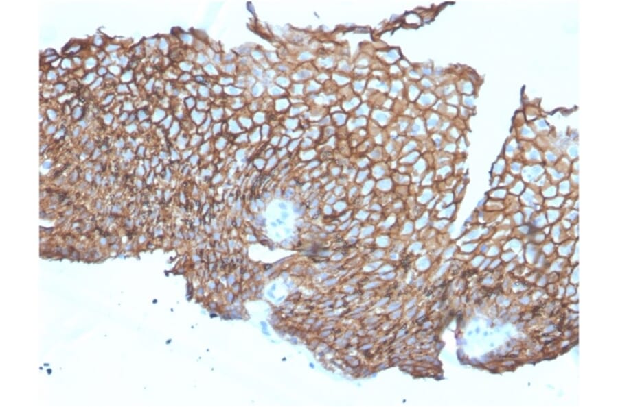 Immunohistochemistry - Anti-Desmoglein 3 Antibody [DSG3/2840] (A248372) - Antibodies.com