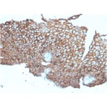 Immunohistochemistry - Anti-Desmoglein 3 Antibody [DSG3/2840] (A248372) - Antibodies.com