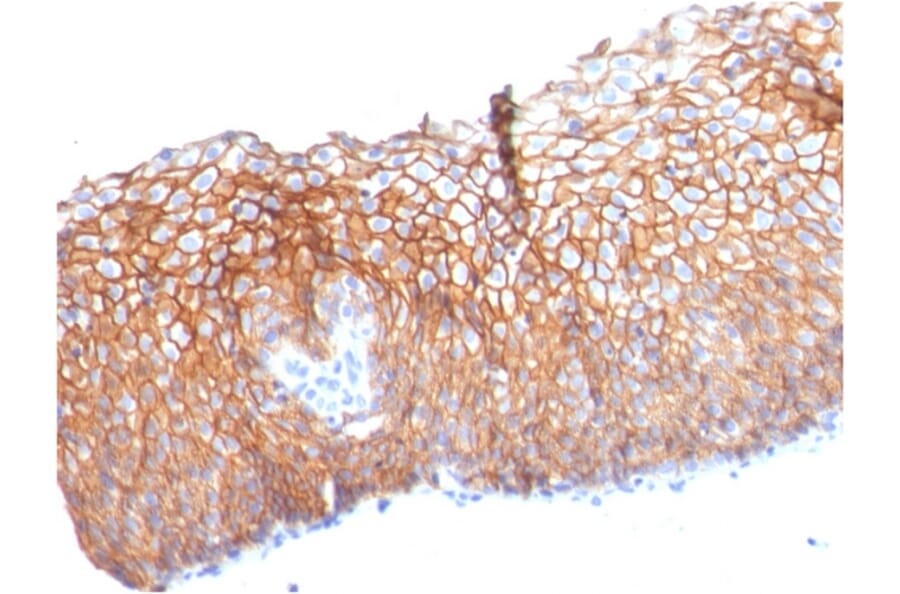 Immunohistochemistry - Anti-Desmoglein 3 Antibody [DSG3/2840] (A248372) - Antibodies.com