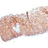 Immunohistochemistry - Anti-Desmoglein 3 Antibody [DSG3/2840] (A248372) - Antibodies.com