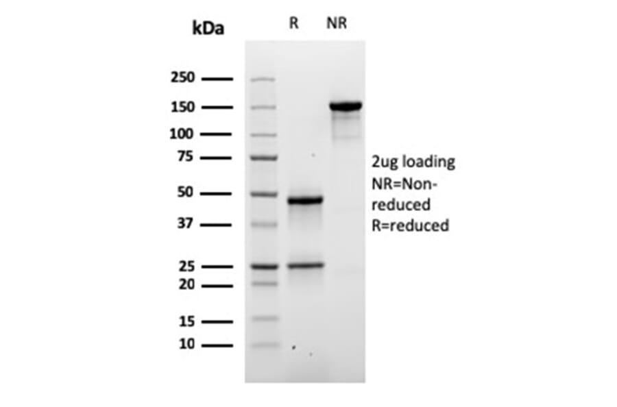 SDS-PAGE - Anti-Desmoglein 3 Antibody [DSG3/2840] (A248372) - Antibodies.com