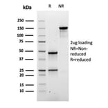 SDS-PAGE - Anti-Desmoglein 3 Antibody [DSG3/2840] (A248372) - Antibodies.com