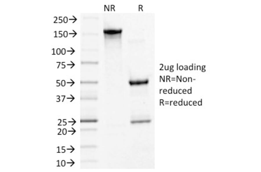 SDS-PAGE - Anti-Desmoglein 3 Antibody [5G11] (A248373) - Antibodies.com