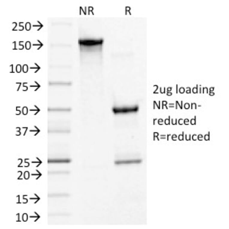 SDS-PAGE - Anti-Desmoglein 3 Antibody [5G11] (A248373) - Antibodies.com