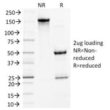 SDS-PAGE - Anti-Desmoglein 3 Antibody [5G11] (A248373) - Antibodies.com