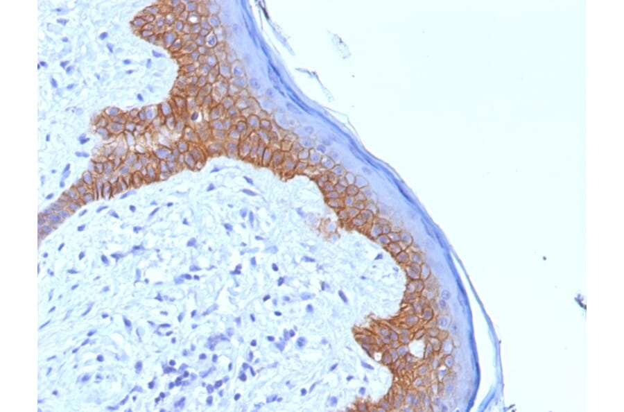 Immunohistochemistry - Anti-Desmoglein 3 Antibody [5G11] (A248372) - Antibodies.com