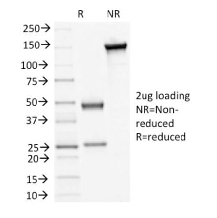 SDS-PAGE - Anti-Desmoglein 3 Antibody [5H10] (A248373) - Antibodies.com