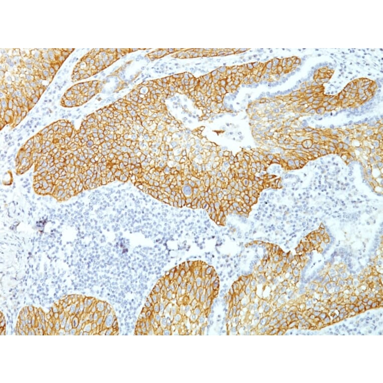 Immunohistochemistry - Anti-Desmoglein 3 Antibody [DSG3/1535] (A248374) - Antibodies.com