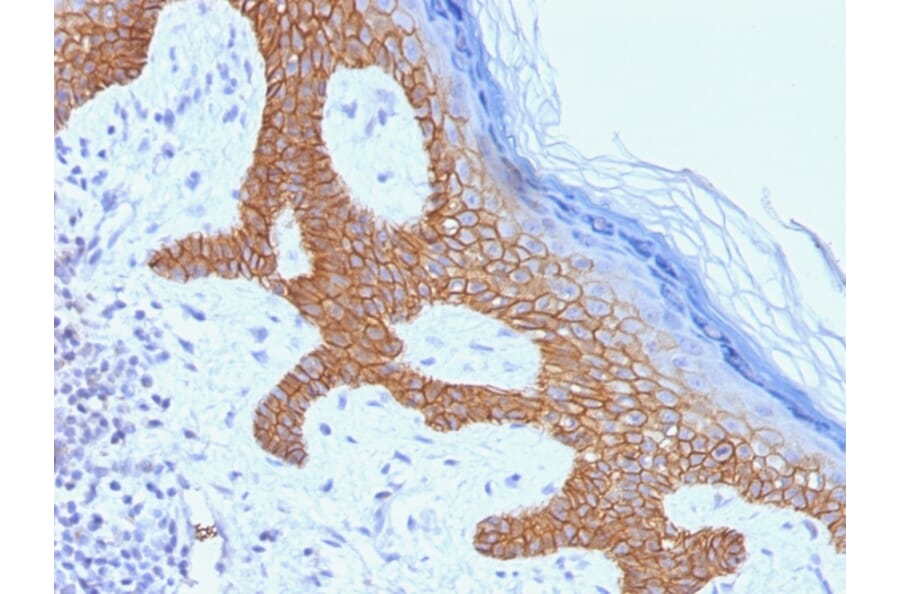 Immunohistochemistry - Anti-Desmoglein 3 Antibody [DSG3/1535] (A248375) - Antibodies.com