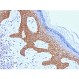 Immunohistochemistry - Anti-Desmoglein 3 Antibody [DSG3/1535] (A248375) - Antibodies.com