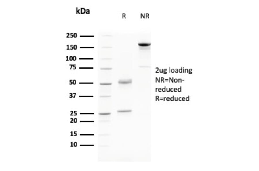 SDS-PAGE - Anti-Desmoglein 3 Antibody [DSG3/2796] (A248376) - Antibodies.com