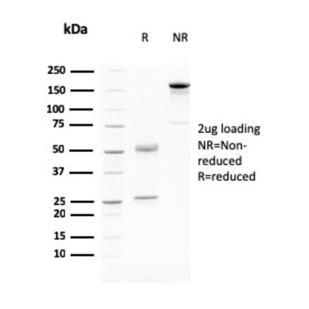 SDS-PAGE - Anti-Desmoglein 3 Antibody [DSG3/2796] (A248376) - Antibodies.com