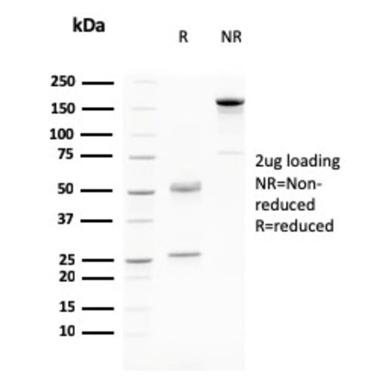 SDS-PAGE - Anti-Desmoglein 3 Antibody [DSG3/2796] (A248376) - Antibodies.com