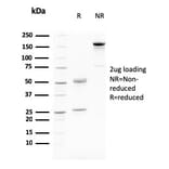 SDS-PAGE - Anti-Desmoglein 3 Antibody [DSG3/2796] (A248376) - Antibodies.com